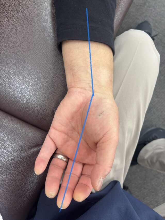 手首のねじれが全身の歪みに関係する写真