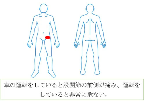 車の運転をすると股関節痛と足の付け根が痛む そんな痛みが全く解消されました 西宮 宝塚で根本改善の整体ならひこばえ整骨院へ