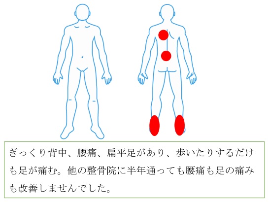 西宮lギックリ背中 腰痛 偏平足による痛みが全てなくなりました 西宮 宝塚で根本改善の整体ならひこばえ整骨院へ