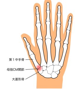 CM関節に軟骨があり、炎症が起きないようにしている