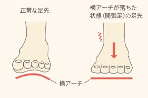 開帳足とは何かを図で示している