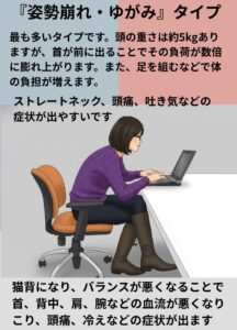 肩こりの原因姿勢の崩れ、歪みタイプ