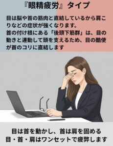 肩こりの眼精疲労タイプ