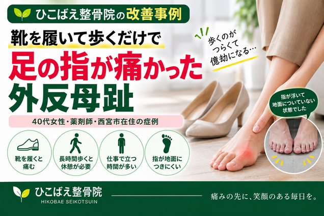 靴を履いて歩くと足の指が痛い外反母趾|40代女性の改善事例|西宮市のひこばえ整骨院