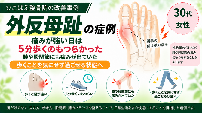 外反母趾で5分歩くのもつらかった|30代女性の症例