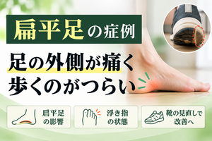 扁平足で足の外側が痛く歩けなくなった症例｜西宮市 ひこばえ整骨院