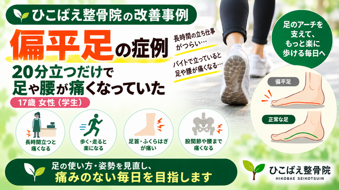 偏平足で長時間立つと足・腰が痛かった17歳女性の症例|西宮市のひこばえ整骨院