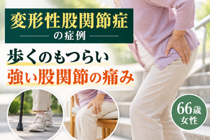 変形性股関節症で歩行が困難だった66歳女性の症例｜西宮市 ひこばえ整骨院
