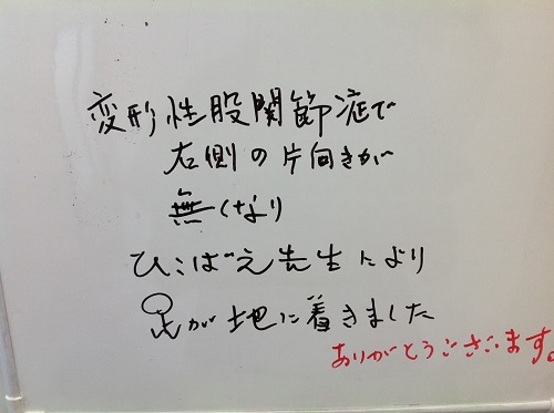 性股関節症の改善事例2