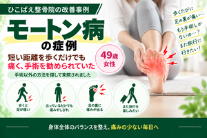 手術を勧められていたモートン病｜49歳女性の症例