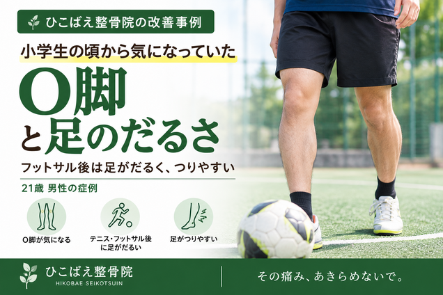 O脚とフットサル後の足のだるさに悩んでいた21歳男性の症例|西宮市 ひこばえ整骨院