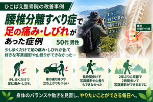 腰椎分離すべり症で長く歩けなかった|50代男性の症例