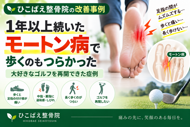 1年以上続くモートン病で歩くのもつらかった症例｜西宮市 ひこばえ整骨院