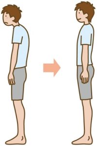 【要注意】頸椎ヘルニアの原因とは？悪化を招く生活習慣と正しい対策法
