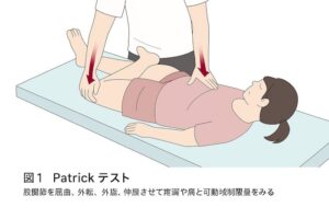 仙腸関節炎を診断するテスト方法２