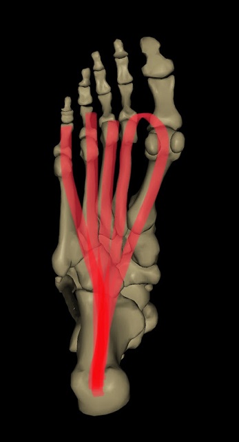 足底腱膜の画像