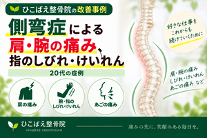 側弯症による肩・腕の痛みや指のしびれで来院された20代の症例｜西宮市 ひこばえ整骨院