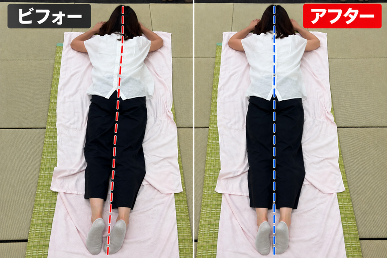 施術前後の身体の状態を確認している様子