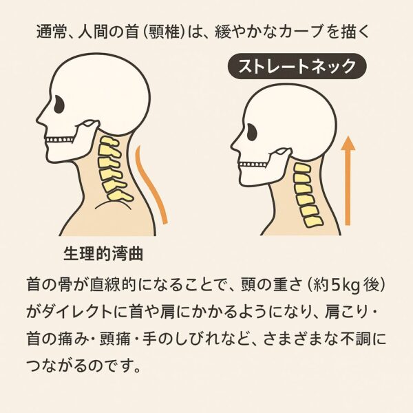 ストレートネックになってしまい、首の湾曲がなくなることで、頭痛、肩、首こりが出る