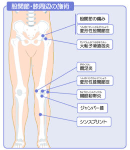 ひこばえ整骨院対応症状股関節膝周辺