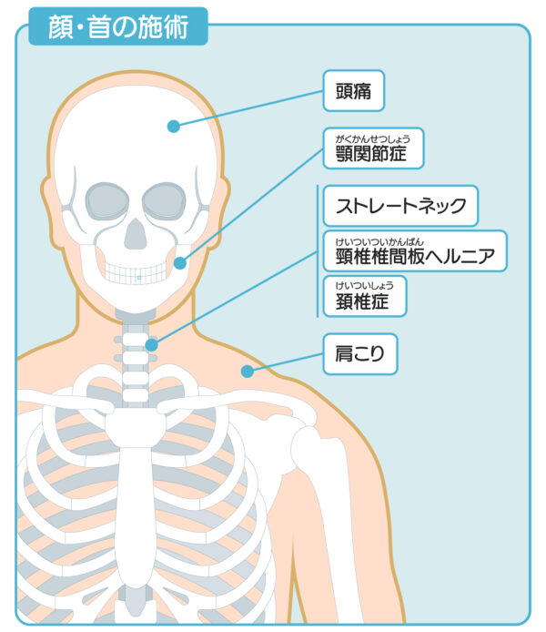 ひこばえ整骨院対応症状首周辺