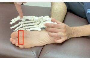 中足骨骨頭痛で痛くなってしまう場所